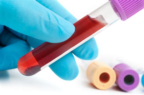 Updated Phlebotomy Tube Color Chart and Test Associations